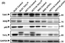 TH1L (D5G6W) Rabbit Monoclonal Antibody | Cell Signaling Technology