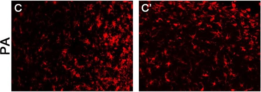 Fig.10.C showing Immunohistochemistry-frozen immunofluorescence in a Rattus norvegicus (Rat) sample from the publication: Neuroprotection Afforded by an Enriched Mediterranean-like Diet Is Modified by Exercise in a Rat Male Model of Cerebral Ischemia.