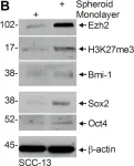 Fig.2.B showing Western Blotting in a Homo sapiens (Human) sample from the publication: Identification of a population of epidermal squamous cell carcinoma cells with enhanced potential for tumor formation.