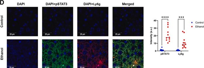 Fig.6.D showing Immunohistochemistry-immunofluorescence in a Mus musculus (House mouse) sample from the publication: IL-6 trans-Signaling Regulates Neutrophilic Inflammation in Alcohol-Associated Hepatitis.