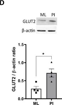 Fig.5.D showing Western Blotting from the publication: Pseudoislet Aggregation of Pancreatic β-Cells Improves Glucose Stimulated Insulin Secretion by Altering Glucose Metabolism and Increasing ATP Production.