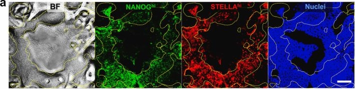 Fig.8.A showing Immunohistochemistry-immunofluorescence in a Homo sapiens (Human) sample from the publication: Substrates mimicking the blastocyst geometry revert pluripotent stem cell to naivety.