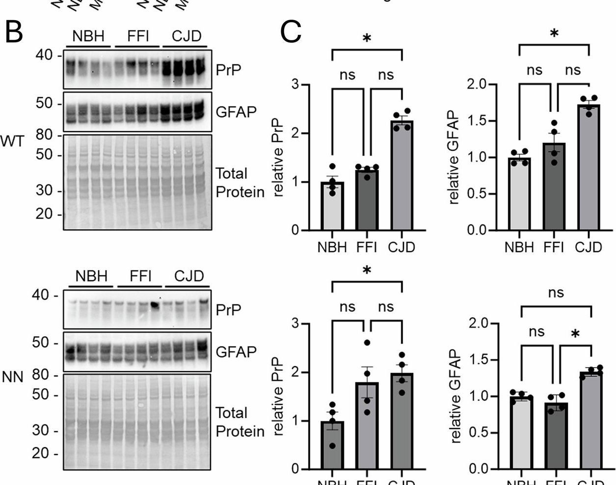 Fig.2.B showing Western Blotting from the publication: Infecting human brain organoids with FFI or sCJD preserves prion traits regardless of host genotype.