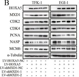 Fig.6.B showing Western Blotting from the publication: HOXA5 inhibits the proliferation of extrahepatic cholangiocarcinoma cells by enhancing MXD1 expression and activating the p53 pathway.