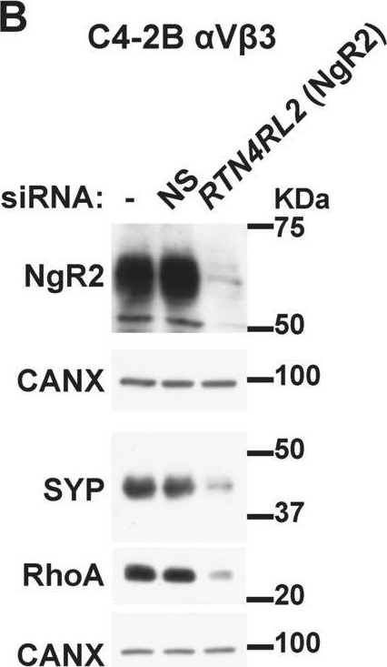 Fig.4.B showing Western Blotting in a Homo sapiens (Human) sample from the publication: The NOGO receptor NgR2, a novel αVβ3 integrin effector, induces neuroendocrine differentiation in prostate cancer.