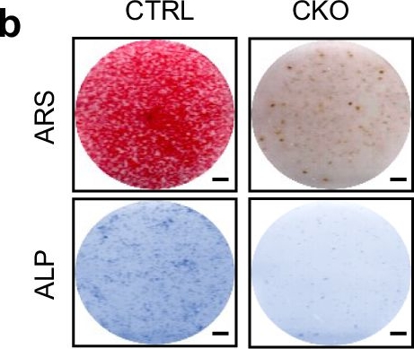 Fig.7.B from the publication: Systematic HOIP interactome profiling reveals critical roles of linear ubiquitination in tissue homeostasis.