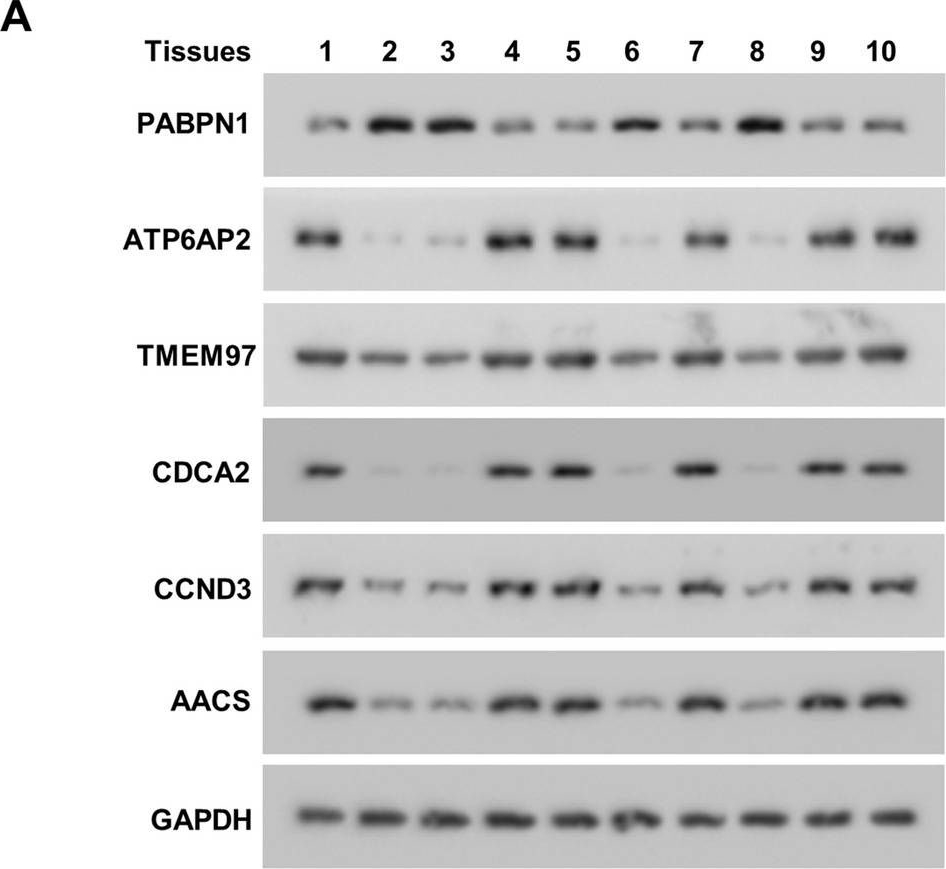 Fig.6.A showing Western Blotting from the publication: PABPN1 regulates mRNA alternative polyadenylation to inhibit bladder cancer progression.