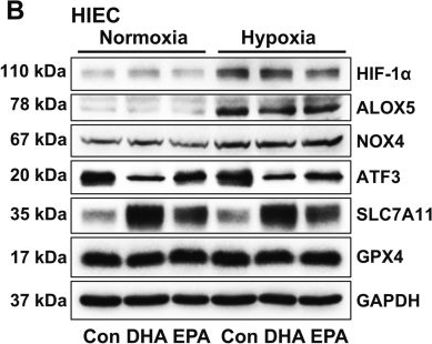 Fig.3.B showing Western Blotting from the publication: DHA and EPA exacerbate hypoxia-induced ferroptosis in gastric and small intestinal mucosa by disrupting the balance between SLC7A11 upregulation and PUFA-PL accumulation.