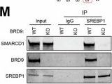 かずと SREBP-1 (E9F4O) Rabbit Monoclonal Antibody | Cell Signaling Technology