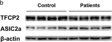 Fig.1.B showing Western Blotting from the publication: Glucose Deficiency Elevates Acid-Sensing Ion Channel 2a Expression and Increases Seizure Susceptibility in Temporal Lobe Epilepsy.