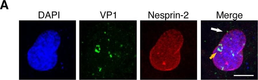 Fig.3.A showing Immunocytochemistry-immunofluorescence in a Homo sapiens (Human) sample from the publication: Components of the LINC and NPC complexes coordinately target and translocate a virus into the nucleus to promote infection.