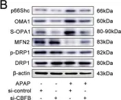 Fig.7.B showing Western Blotting from the publication: circ-CBFB upregulates p66Shc to perturb mitochondrial dynamics in APAP-induced liver injury.