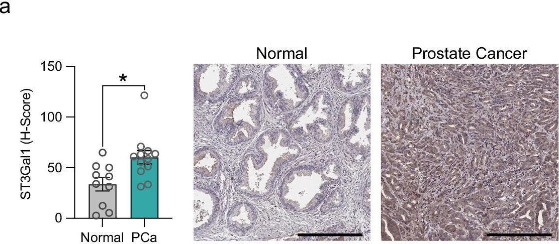 Fig.1.A showing Immunohistochemistry in a Homo sapiens (Human) sample from the publication: ST3 beta-galactoside alpha-2,3-sialyltransferase 1 (ST3Gal1) synthesis of Siglec ligands mediates anti-tumour immunity in prostate cancer.
