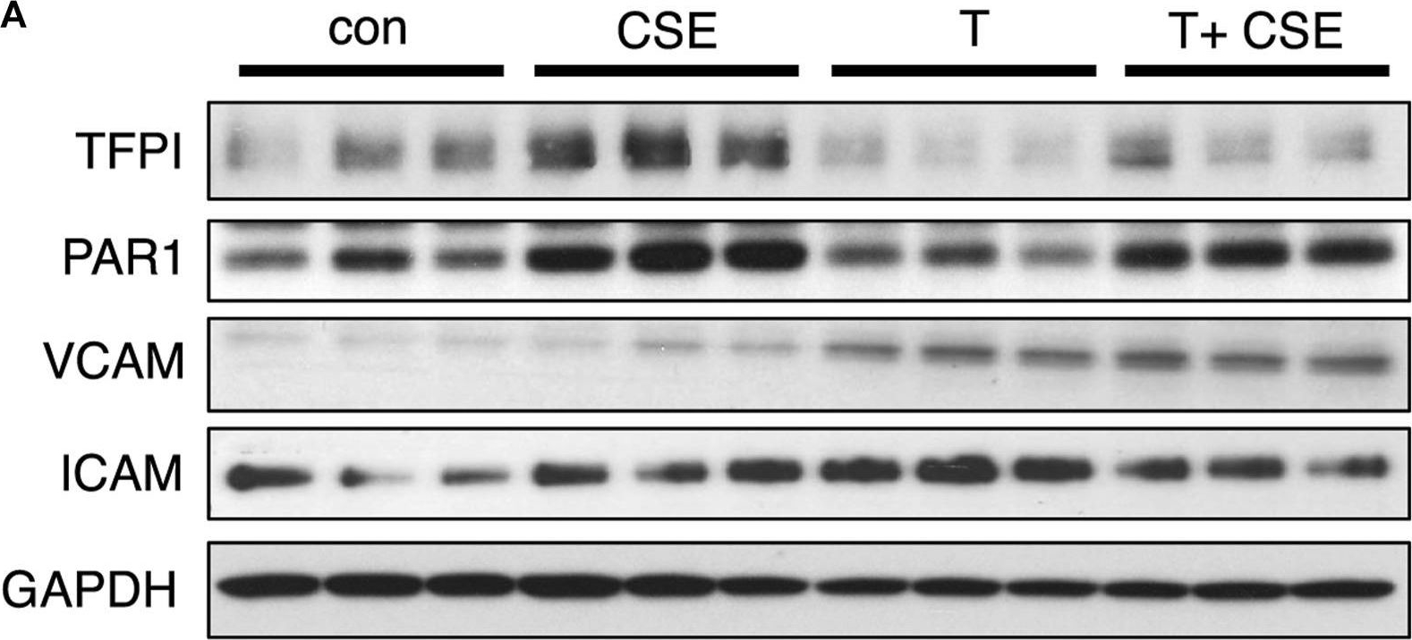Fig.2.A showing Western Blotting in a Mus musculus (House mouse) sample from the publication: Lung lymphatic endothelial cells undergo inflammatory and prothrombotic changes in a model of chronic obstructive pulmonary disease.