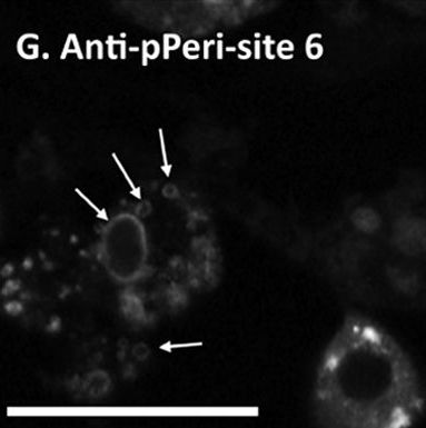 Differential phosphorylation of perilipin 1A at the initiation of lipolysis revealed by novel monoclonal antibodies and high content analysis.