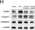 Fig.4.H showing Western Blotting in a Homo sapiens (Human) sample from the publication: Epicatechin inhibits inflammatory injury in preeclampsia extravillous trophoblasts.
