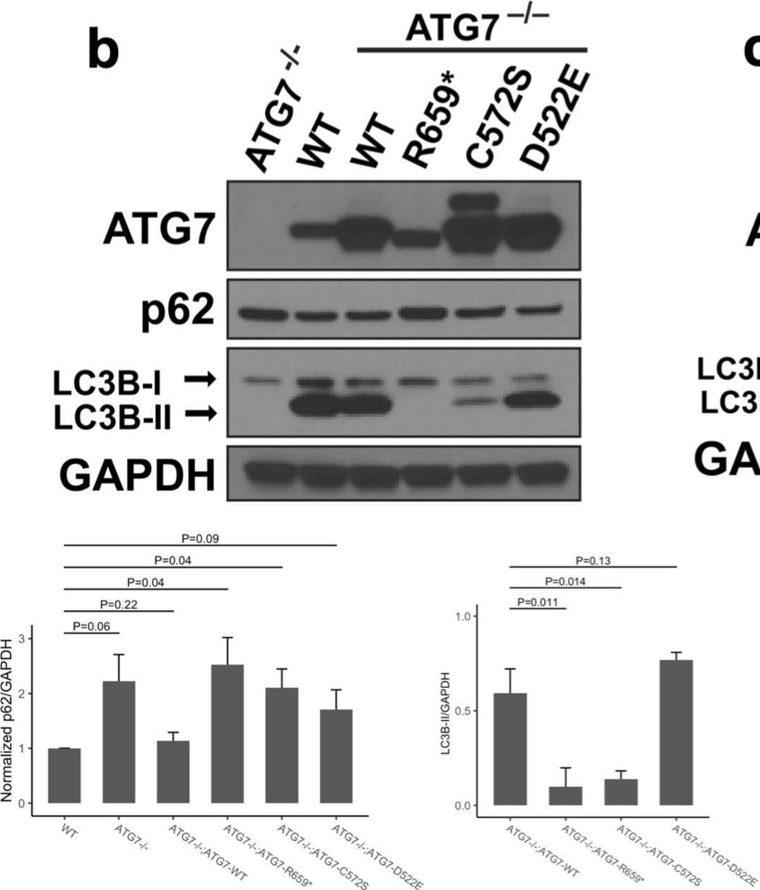 Fig.5.B showing Western Blotting from the publication: Germline variants of ATG7 in familial cholangiocarcinoma alter autophagy and p62.