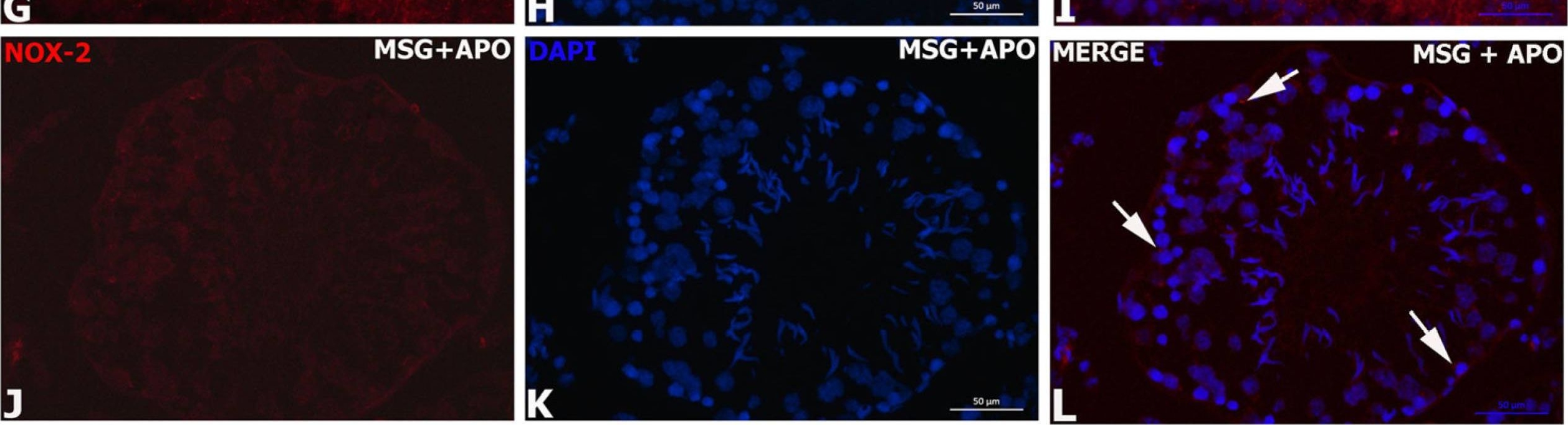 Fig.5.G showing Immunohistochemistry-immunofluorescence in a Rattus norvegicus (Rat) sample from the publication: Apocynin Ameliorates Monosodium Glutamate Induced Testis Damage by Impaired Blood-Testis Barrier and Oxidative Stress Parameters.