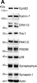 Fig.3.A showing Western Blotting from the publication: The ephrin receptor EphB2 regulates the connectivity and activity of enteric neurons.