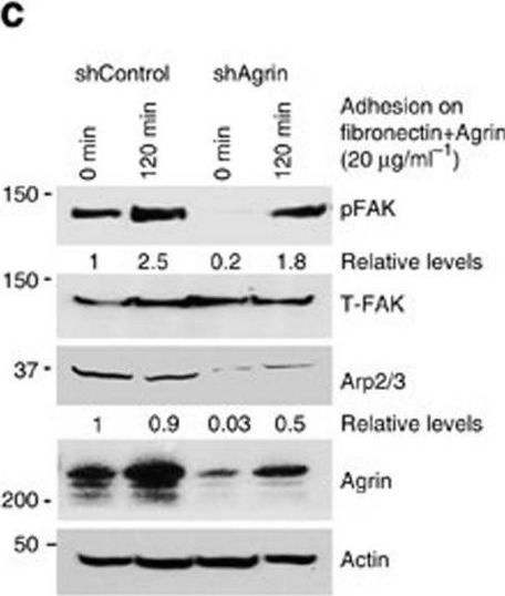 Fig.6.C showing Western Blotting from the publication: An oncogenic role of Agrin in regulating focal adhesion integrity in hepatocellular carcinoma.