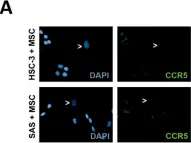 Fig.5.A showing Immunocytochemistry-immunofluorescence from the publication: Human bone marrow mesenchymal stem cells induce collagen production and tongue cancer invasion.