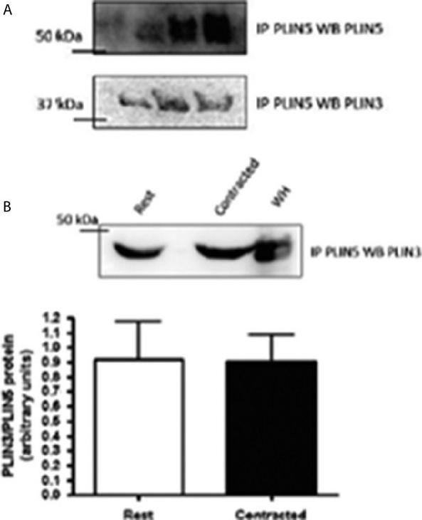 Higher PLIN5 but not PLIN3 content in isolated skeletal muscle mitochondria following acute in vivo contraction in rat hindlimb.