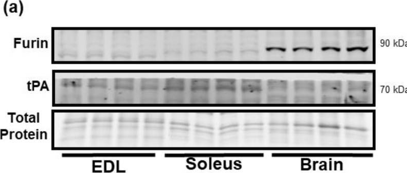Fig.3.A showing Western Blotting from the publication: ProBDNF Upregulation in Murine Hind Limb Ischemia Reperfusion Injury: A Driver of Inflammation.