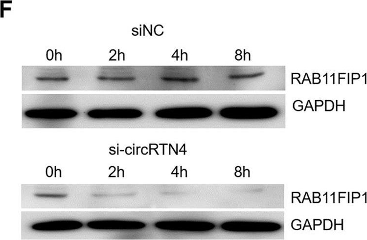 Fig.5.F showing Western Blotting in a Homo sapiens (Human) sample from the publication: CircRTN4 promotes pancreatic cancer progression through a novel CircRNA-miRNA-lncRNA pathway and stabilizing epithelial-mesenchymal transition protein.