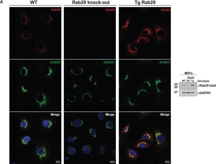 Fig.4.A showing Immunocytochemistry-immunofluorescence in a Mus musculus (House mouse) sample from the publication: Endogenous Rab29 does not impact basal or stimulated LRRK2 pathway activity.