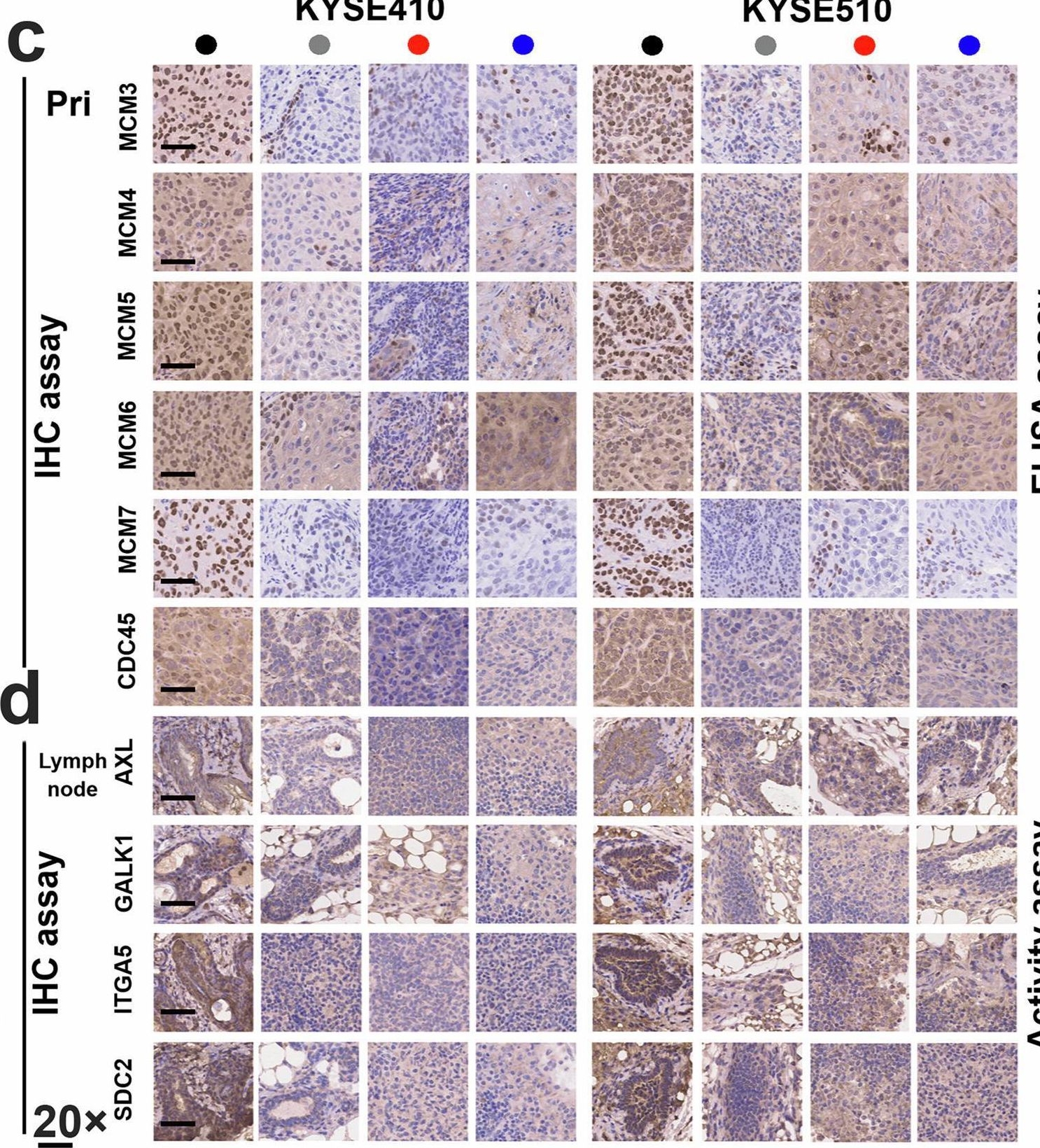 Fig.7.C showing Immunohistochemistry in a Homo sapiens (Human) sample from the publication: Focal adhesion kinase/Src family kinase axis-mediated tyrosine phosphorylation of metabolic enzymes facilitates tumor metastasis.