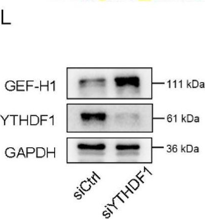 Fig.5.L showing Western Blotting in a Homo sapiens (Human) sample from the publication: A novel mechanism of FTO modulating the progression of endometriosis through mediating the m6A methylation of GEF-H1 in a YTHDF1-dependent manner.