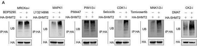 Fig.4.A from the publication: Phosphorylated SHMT2 Regulates Oncogenesis Through m6A Modification in Lung Adenocarcinoma.