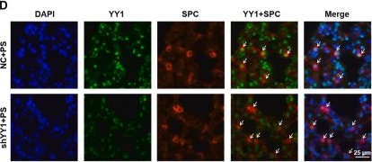 Fig.7.D showing Immunohistochemistry-immunofluorescence from the publication: Polystyrene nanoplastics-induced lung epithelial cells ferroptosis promotes pulmonary fibrosis via YY1/FTL axis.