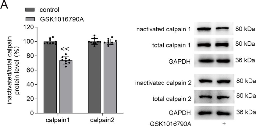 Fig.5.A showing Western Blotting in a Mus musculus (House mouse) sample from the publication: Transient receptor potential vanilloid 4 blockage attenuates pyroptosis in hippocampus of mice following pilocarpine‑induced status epilepticus.
