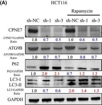 Fig.6.A showing Western Blotting from the publication: Depletion of CPNE7 sensitizes colorectal cancer to 5-fluorouracil by downregulating ATG9B expression.