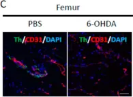Fig.1.C showing Immunohistochemistry-immunofluorescence from the publication: The Sympathetic Nervous System Contributes to the Establishment of Pre-Metastatic Pulmonary Microenvironments.