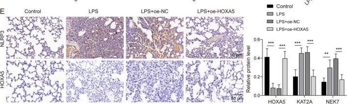 Fig.6.E showing Immunohistochemistry in a Mus musculus (House mouse) sample from the publication: HOXA5 Suppresses NEK7-Mediated Alveolar Epithelial Pyroptosis in Acute Lung Injury by Transcriptionally Inhibiting KAT2A.