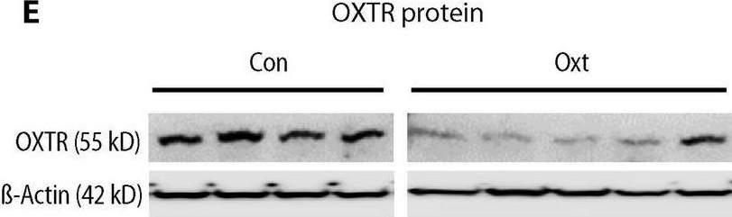 Fig.3.E showing Western Blotting from the publication: Labor induction with oxytocin in pregnant rats is not associated with oxidative stress in the fetal brain.
