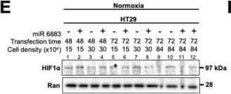 Fig.1.E showing Western Blotting from the publication: miR-6883 downregulates HIF1α in colorectal and breast cancer cells.