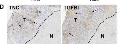 Fig.3.D showing Immunohistochemistry from the publication: Proteomic Profiling of Extracellular Matrix Components from Patient Metastases Identifies Consistently Elevated Proteins for Developing Nanobodies That Target Primary Tumors and Metastases.