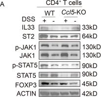 Fig.5.A showing Western Blotting in a Mus musculus (House mouse) sample from the publication: CCL5 deficiency aggravates acute DSS-induced colitis by restricting IL-33-induced formation of Tregs in intestinal tract.