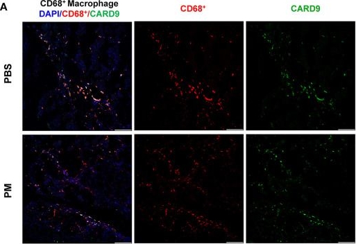 Fig.3.A showing Immunohistochemistry-immunofluorescence in a Mus musculus (House mouse) sample from the publication: CARD9 deficiency improves the recovery of limb ischemia in mice with ambient fine particulate matter exposure.