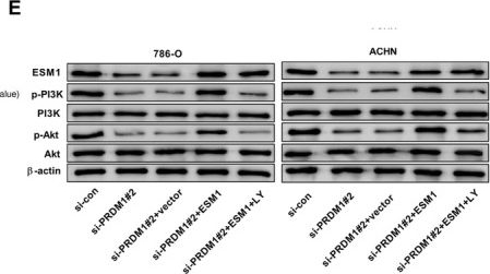 Fig.5.E showing Western Blotting from the publication: PRDM1 Knockdown Promotes Ferroptosis and Sunitinib Sensitivity by Modulating the PI3K/Akt Signaling Through Inhibition of ESM1 Transcription in Renal Cell Carcinoma.
