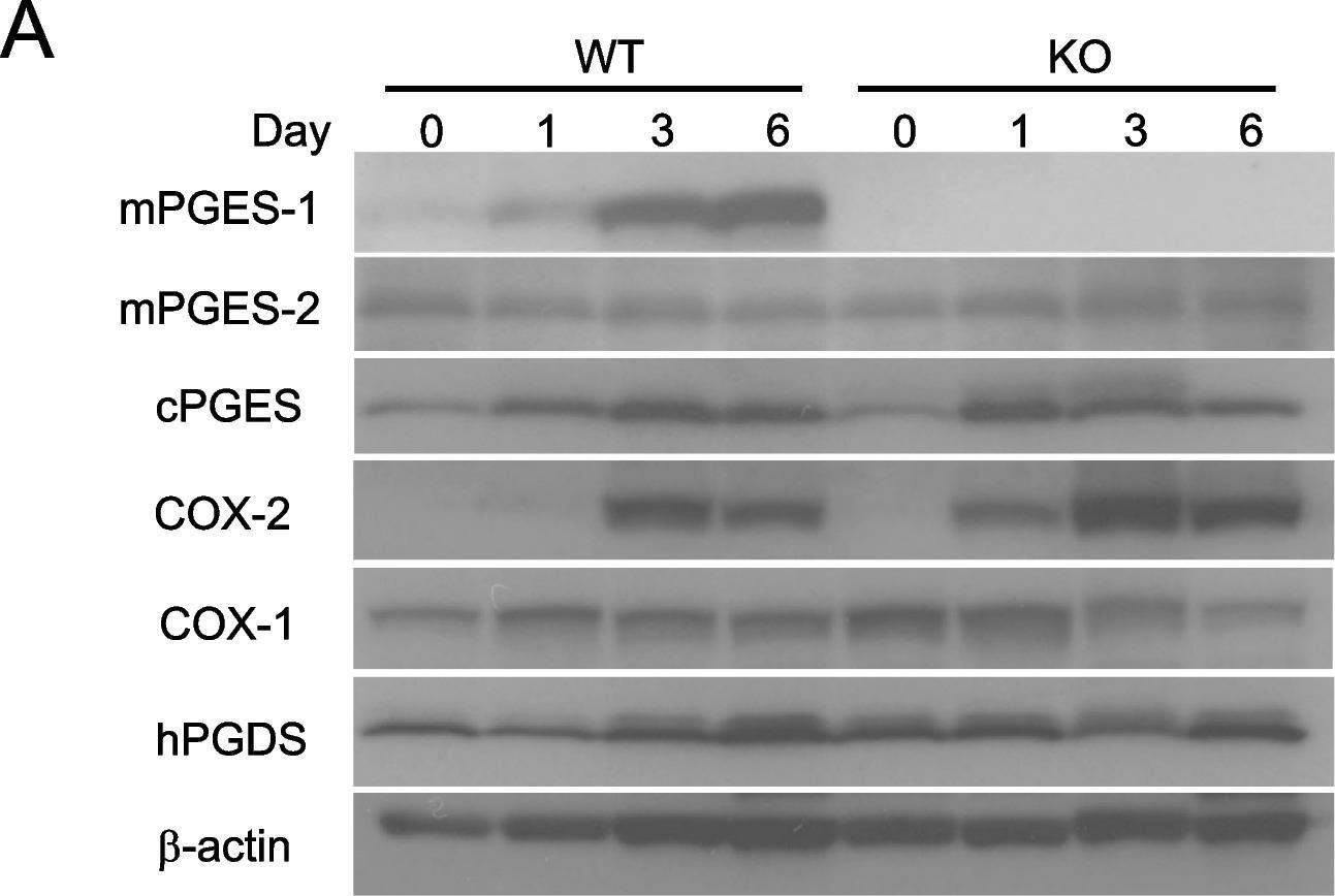 Fig.5.A showing Western Blotting in a Mus musculus (House mouse) sample from the publication: Genetic deletion of microsomal prostaglandin E synthase-1 promotes imiquimod-induced psoriasis in mice.