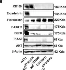 Fig.6.B showing Western Blotting from the publication: CD109 Is a Critical Determinant of EGFR Expression and Signaling, and Tumorigenicity in Squamous Cell Carcinoma Cells.