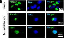 Fig.1.E showing Immunocytochemistry-immunofluorescence in a Homo sapiens (Human) sample from the publication: The dynamic expression of YAP is essential for the development of male germ cells derived from human embryonic stem cells.