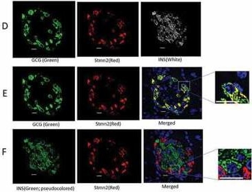 Fig.1.D showing Immunocytochemistry-immunofluorescence in a Mus musculus (House mouse) sample from the publication: Misrouting of glucagon and stathmin-2 towards lysosomal system of α-cells in glucagon hypersecretion of diabetes.