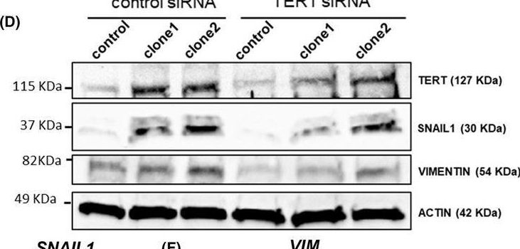 Fig.5.D showing Western Blotting in a Homo sapiens (Human) sample from the publication: MicroRNA 196a contributes to the aggressiveness of&nbsp;esophageal adenocarcinoma through the MYC/TERT/NFκB axis.