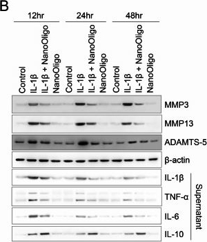 Fig.3.B showing Western Blotting from the publication: Adenosine and guanosine-based oligonucleotides-loaded PLGA nanoparticles attenuates progression of surgically induced osteoarthritis.