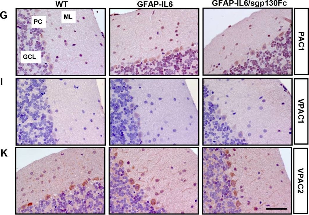 Fig.5.G showing Immunohistochemistry from the publication: Increased Expression of the Neuropeptides PACAP/VIP in the Brain of Mice with CNS Targeted Production of IL-6 Is Mediated in Part by Trans-Signalling.